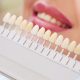 wybielanie zębów toruń - esthetic dental clinic